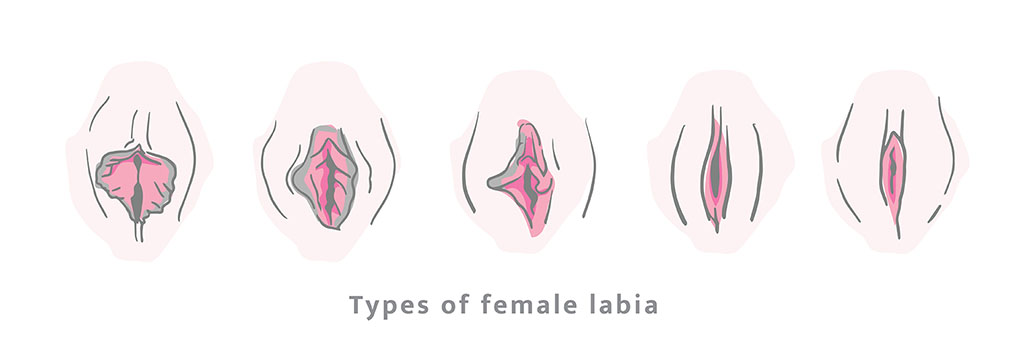 Causes of Labial Hypertrophy