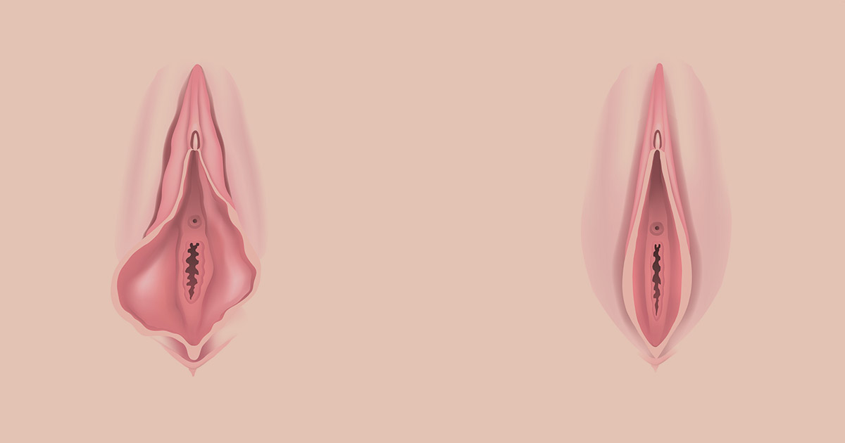 Labiaplasty and Combined Treatments