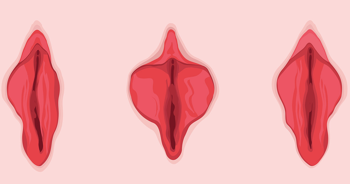 What Is the Best Treatment for Labial Hypertrophy